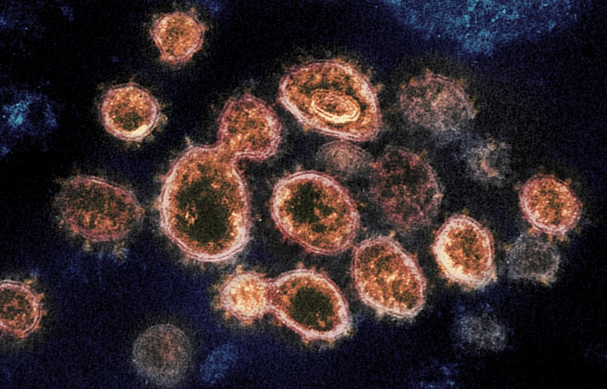 COVID, coronavirus
