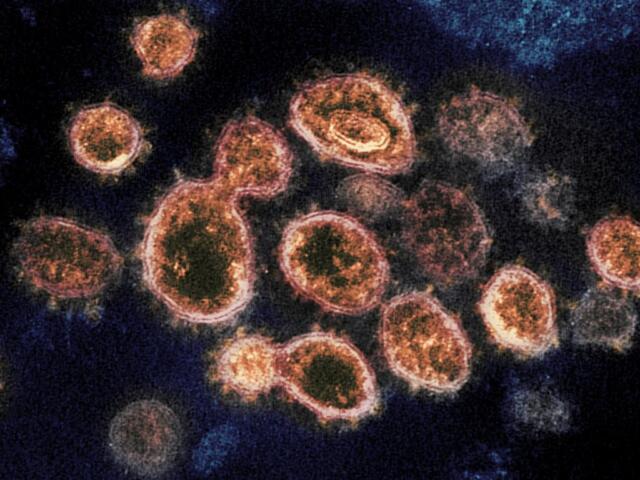 COVID, coronavirus
